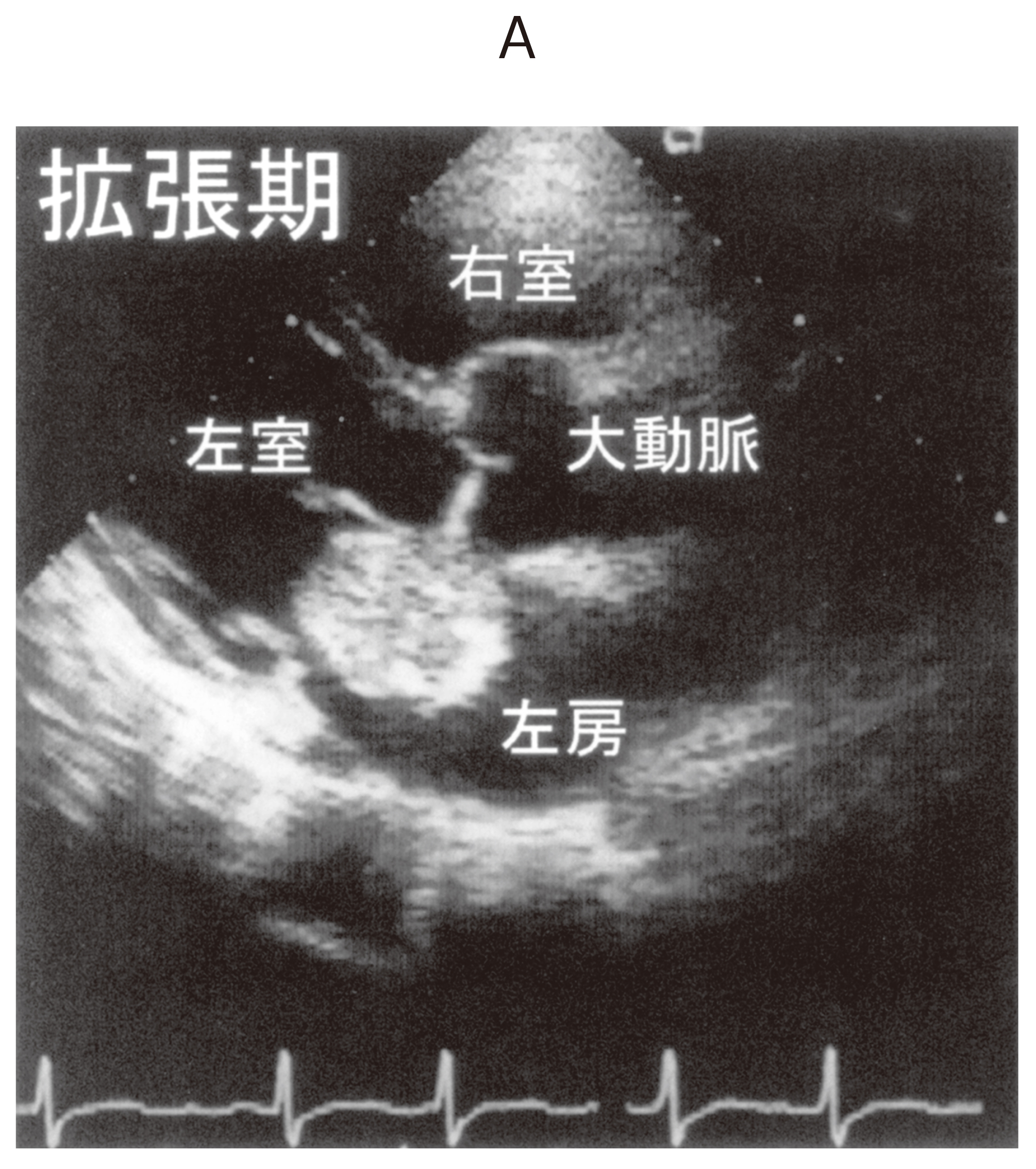 94F10 | 心臓腫瘍 国試 | テコプラ