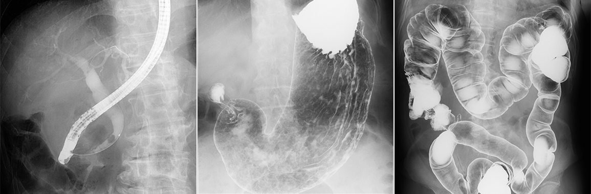 X線テレビ｜中央放射線部｜独立行政法人 国立病院機構 災害医療センター