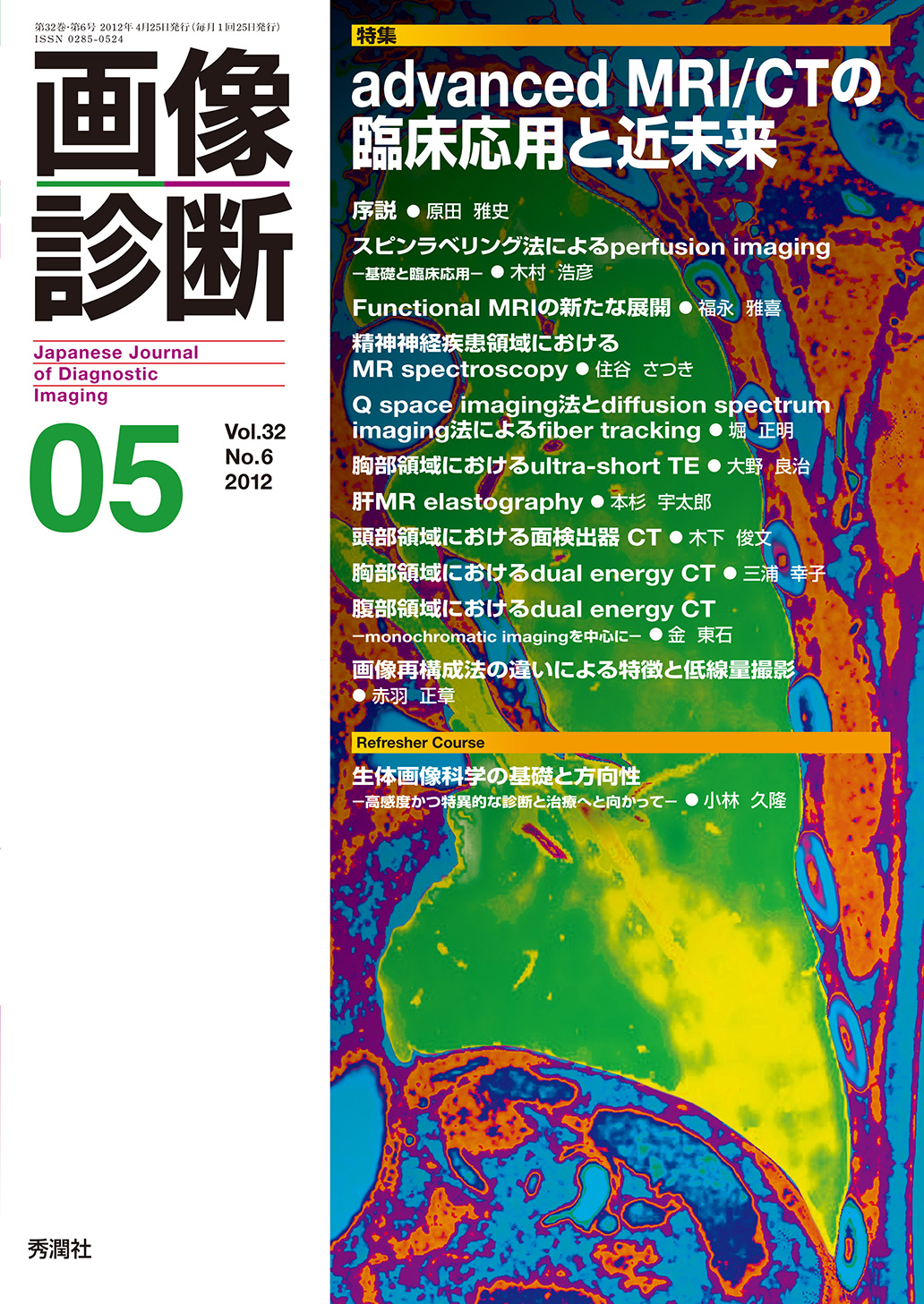 画像診断 Vol.32 No.6【電子版】 | 医書.jp