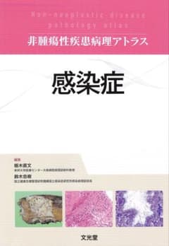 非腫瘍性疾患病理アトラス 感染症 裁断済み - メルカリ