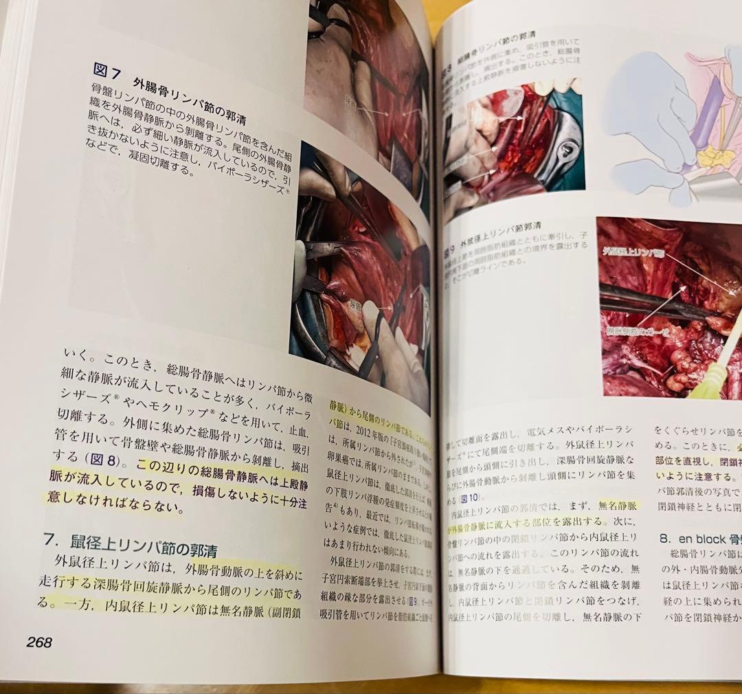 産婦人科手術スタンダード 改訂第２版 日本産婦人科手術学会編