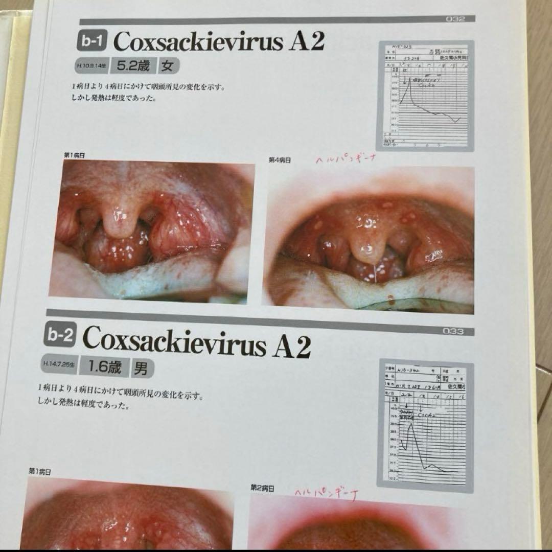 アトラスさくま 小児咽頭所見 フルカラーオリジナル症例写真284点