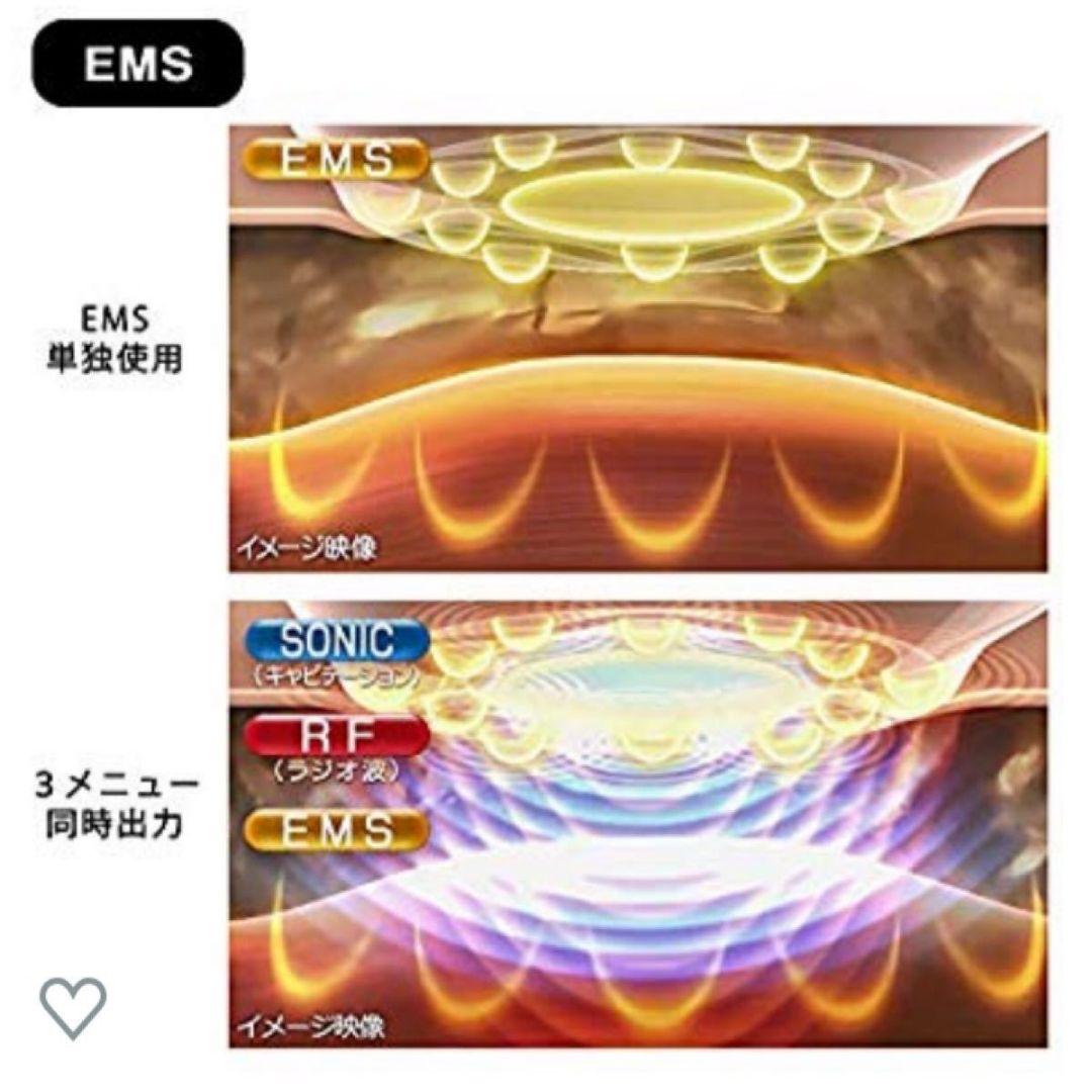 ダイエット　キャビテーション