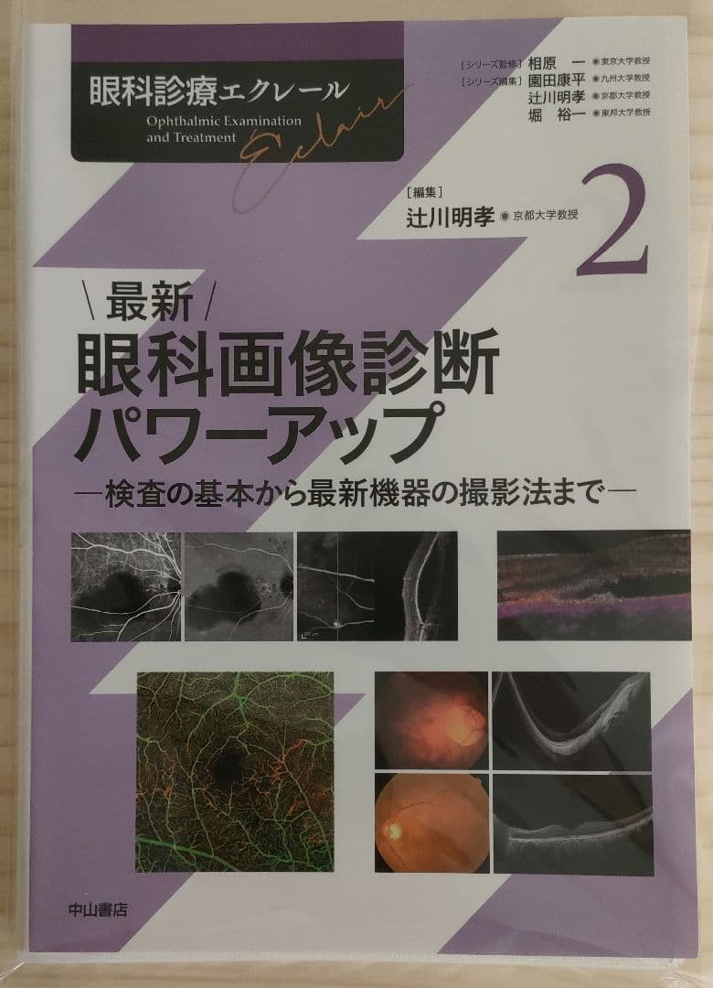 【裁断済】眼科診療エクレール 眼科画像診断パワーアップ 最新 眼科画像診断パワーアップ (眼科診療エクレール 2) | 辻川明孝