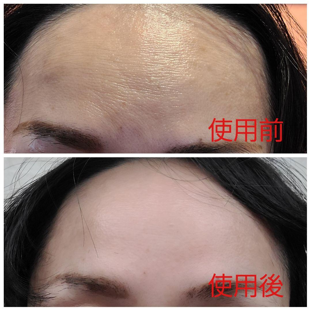 ヴィジョン・ド・ボーテ高濃度シワとりクリーム塗るボトックス - メルカリ