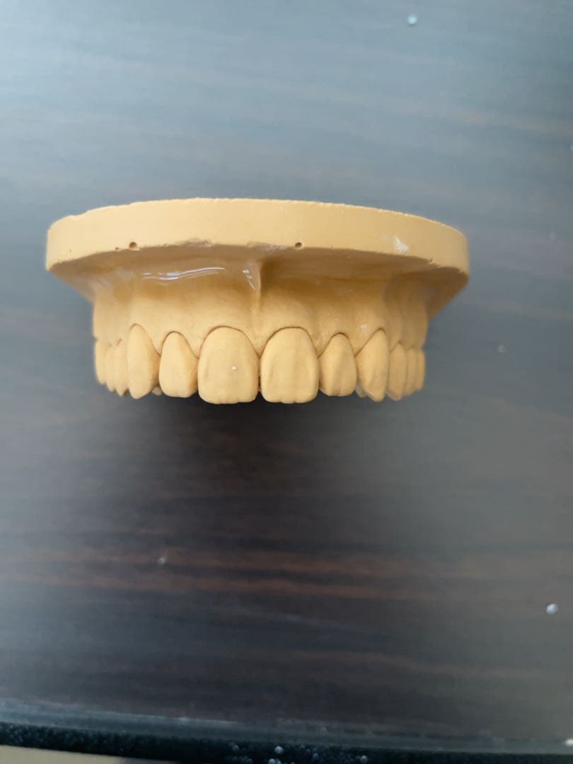 歯科技工 ワセトレ難波氏のサンプル模型です！