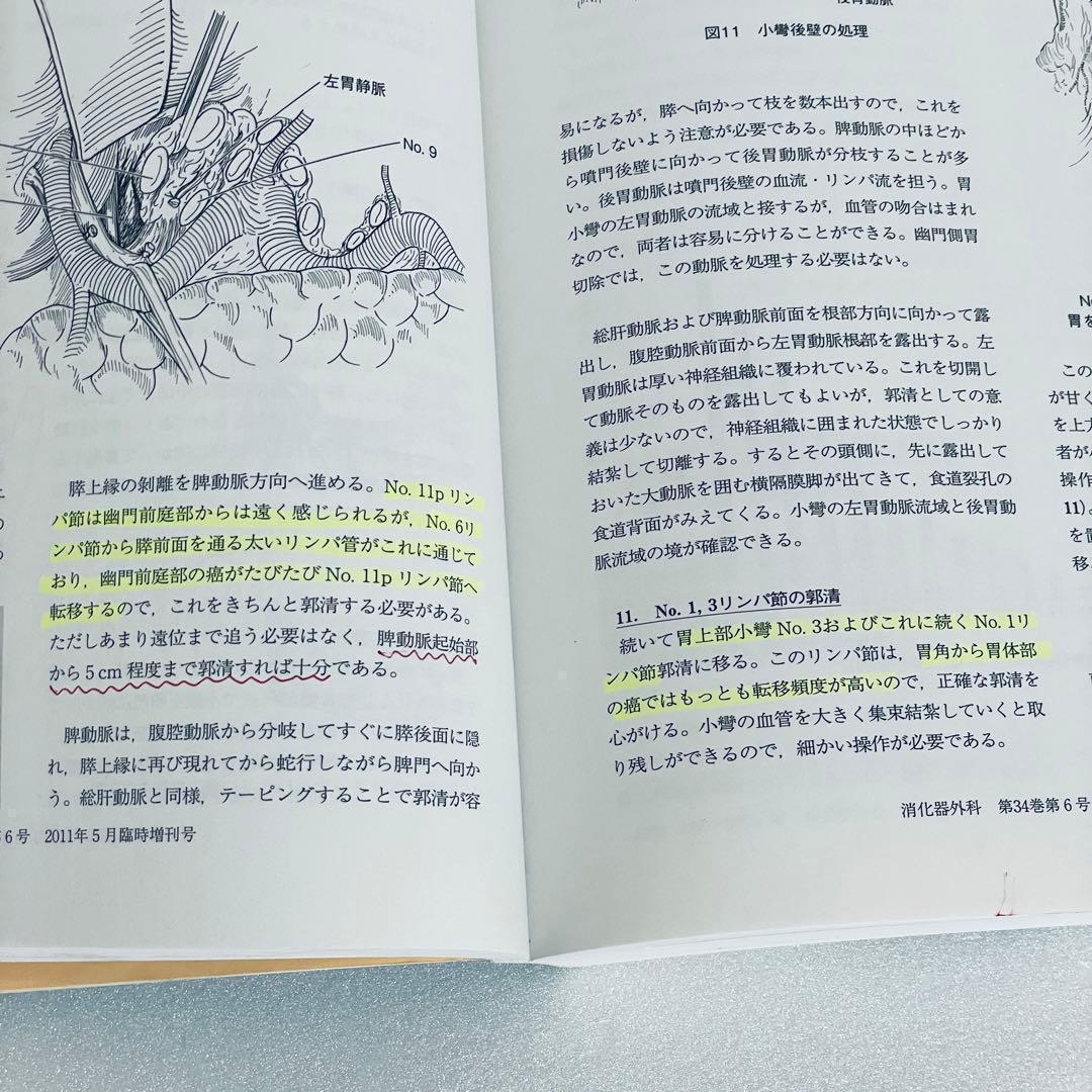 消化器外科 2011年5月号 アトラスで学ぶ達人の手術 臨時増刊号 - メルカリ