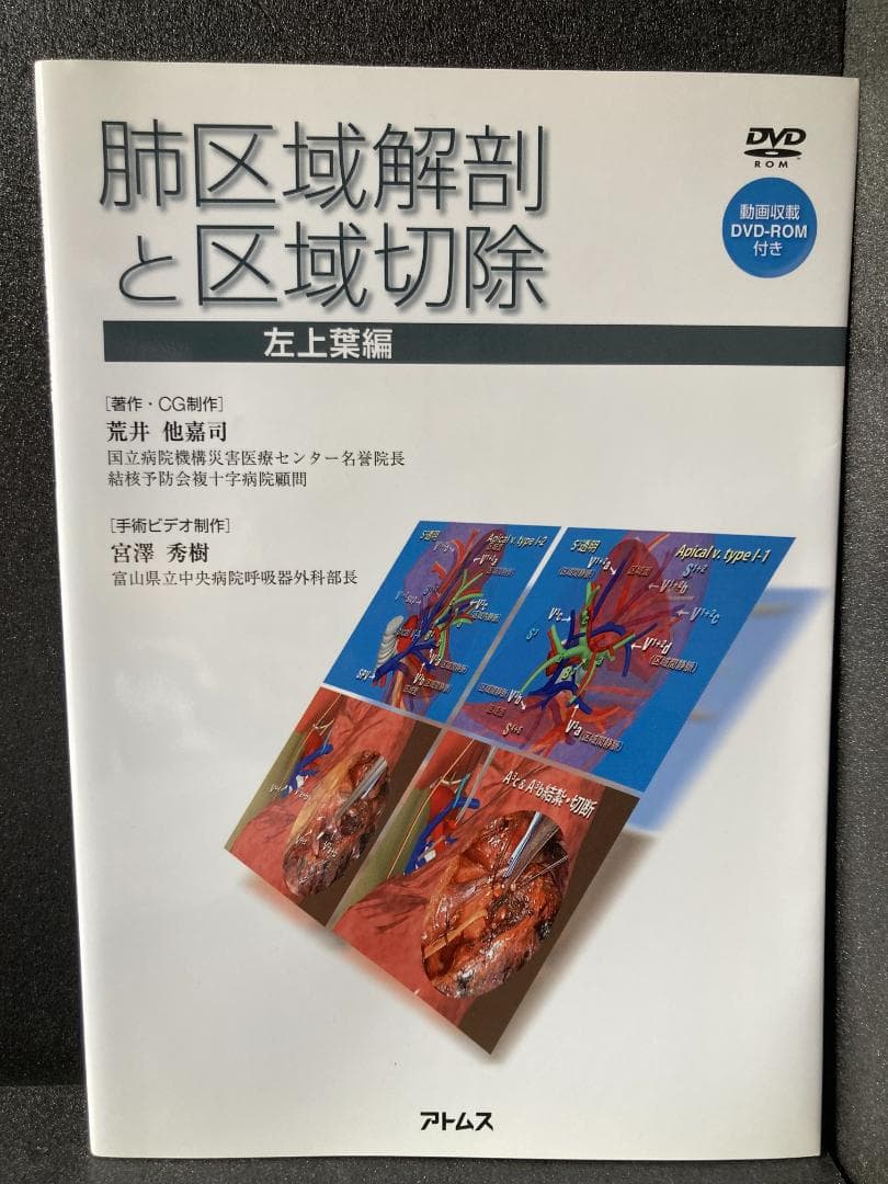 肺区域解剖と区域切除 -左上葉編- [DVD-ROM付き]