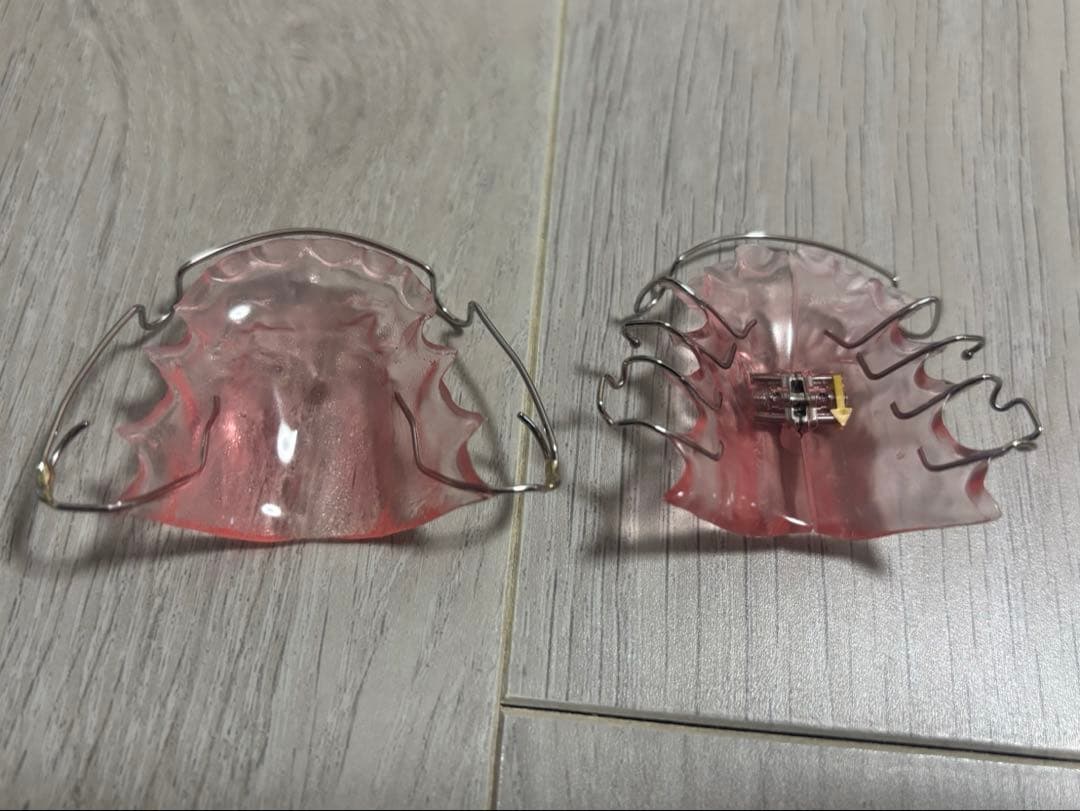 サンプル　歯科矯正　リテーナー　拡大床 サンプル 歯科矯正 リテーナー 拡大床