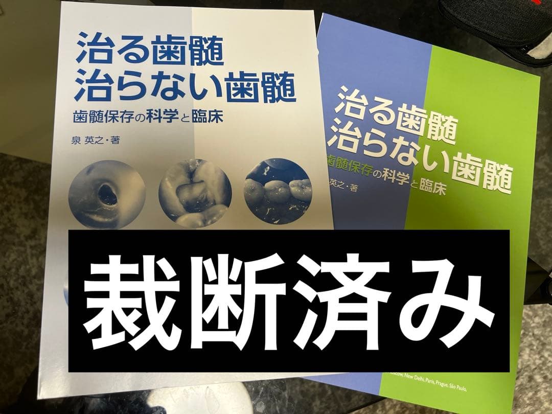 治る歯髄　治らない歯髄　裁断 治る歯髄 治らない歯髄 - クインテッセンス出版