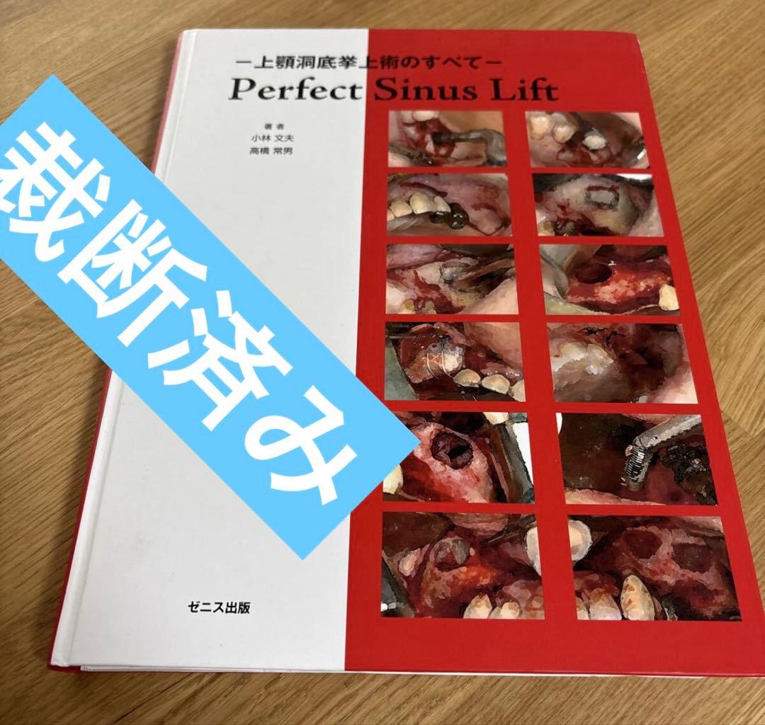 Perfect Sinus Lift - 上顎洞底挙上のすべて 基礎から学ぶ 歯槽頂アプローチによる上顎洞挙上手術の原理と法則
