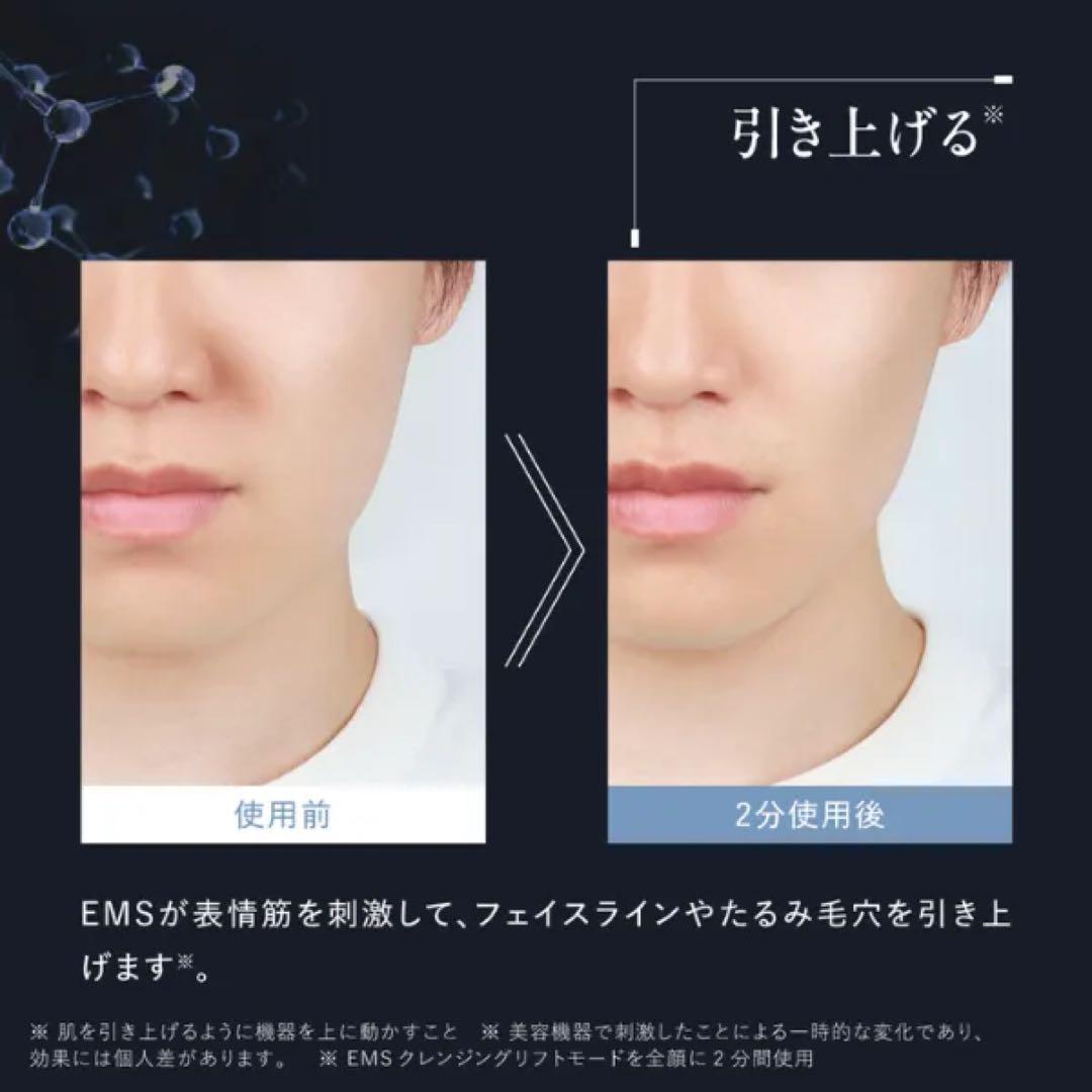 新品未開封】アンファー EMS 電動 洗顔ブラシ 29700円 - メルカリ