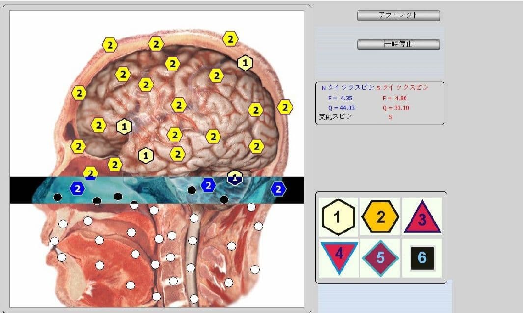 期間限定セール☆波動測定器18D NLS メタトロン ニュースキャン