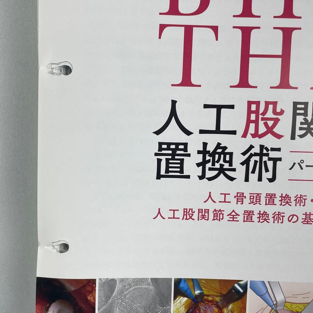 裁断済】BHA・THA 人工股関節置換術パーフェクト - メルカリ