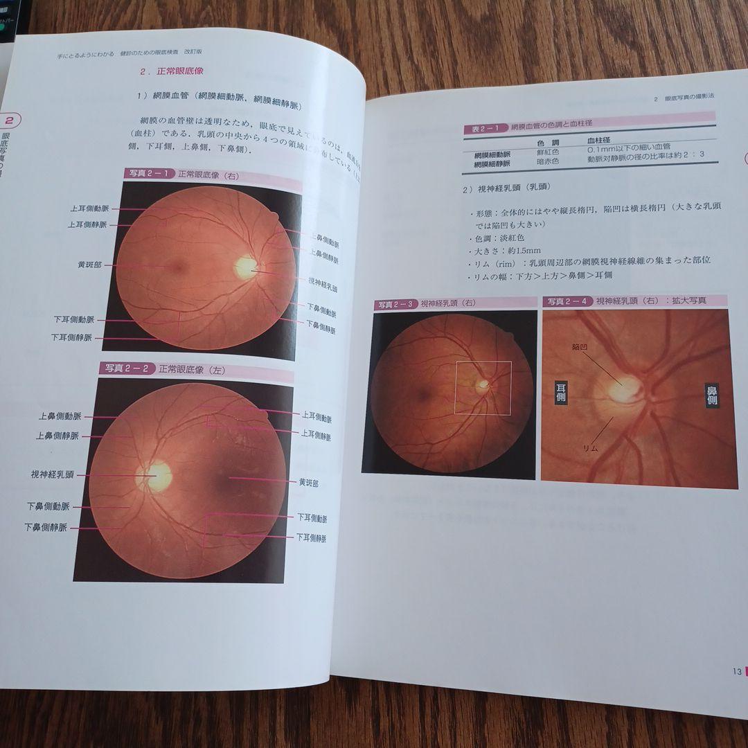 手にとるようにわかる健診のための眼底検査 : 無散瞳カメラによる撮影