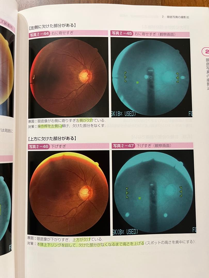 手にとるようにわかる健診のための眼底検査 改訂版 無散瞳カメラによる