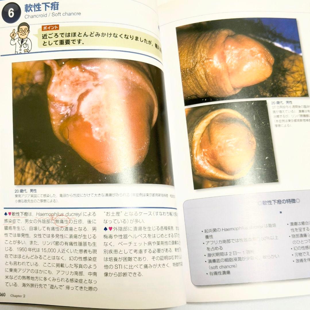 外陰部疾患 プライベートパーツの診かた