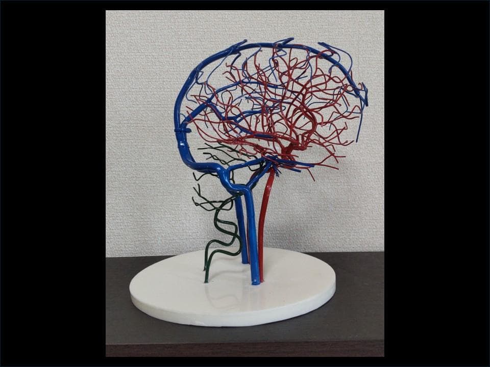 脳血管模型(内頚動脈・椎骨動脈・脳静脈) - メルカリ