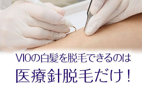 VIOの白髪の脱毛ができるのは医療ニードル（針）脱毛だけ | 新宿/渋谷