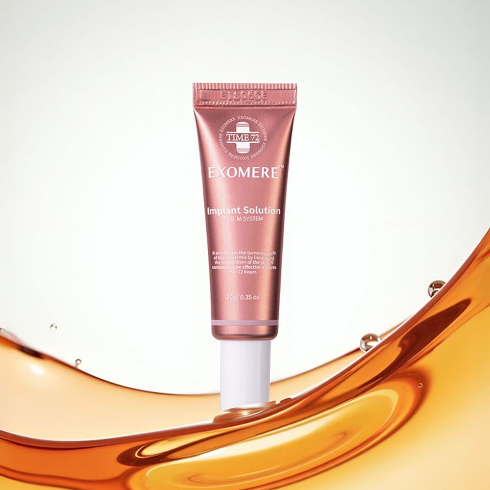 img_inplant_001.png?v=