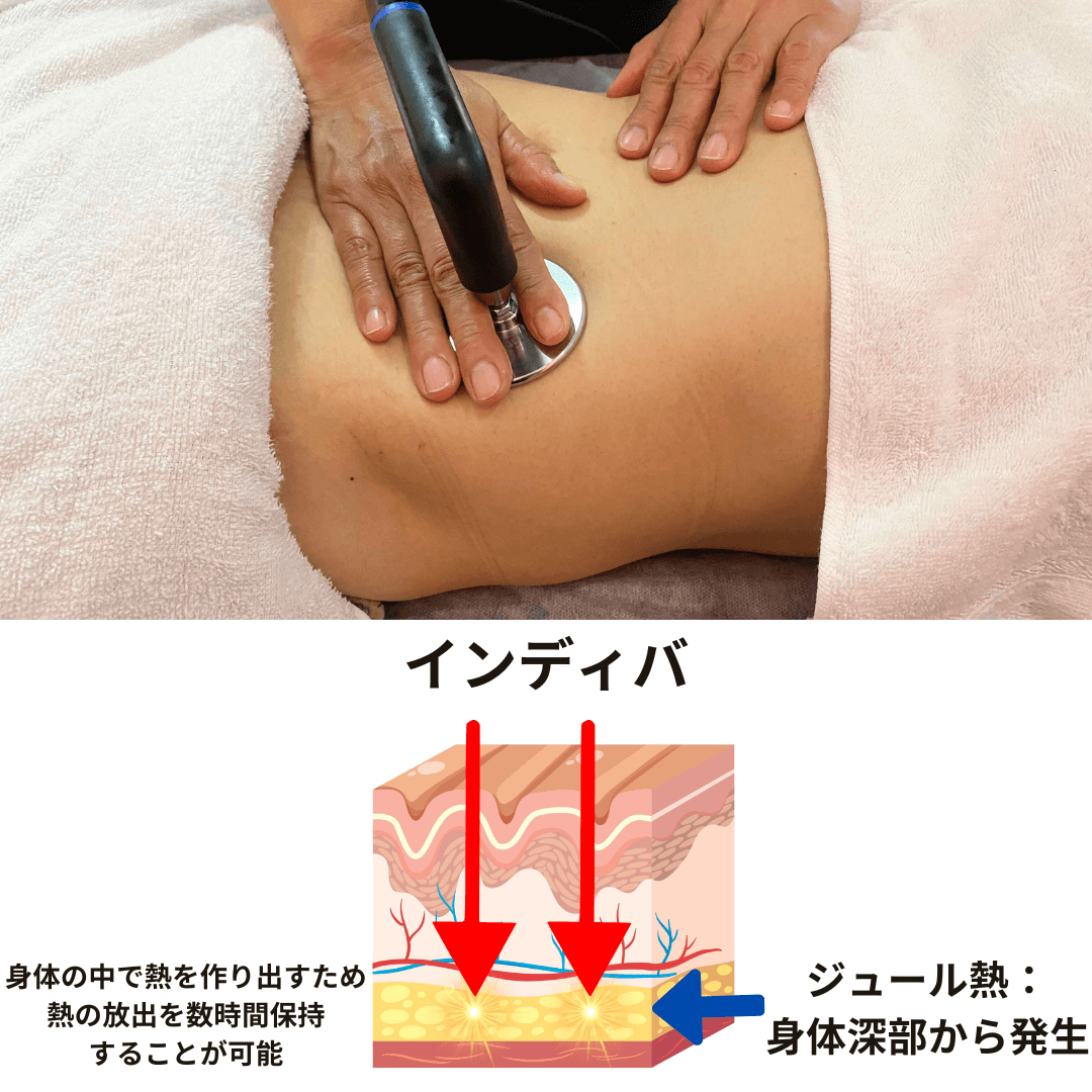 PREMIUM INDIBAについて - 美肌さいさい (Bihadasaisai)