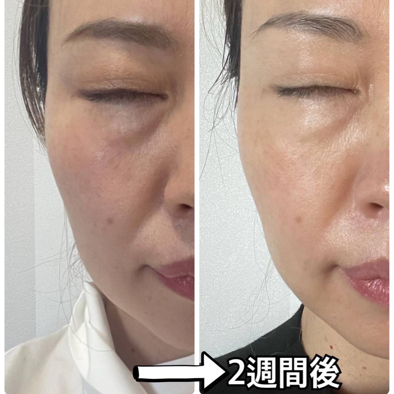 新品未使用シックスパッドフェイシャルフィット SIXPAD Facial Fit