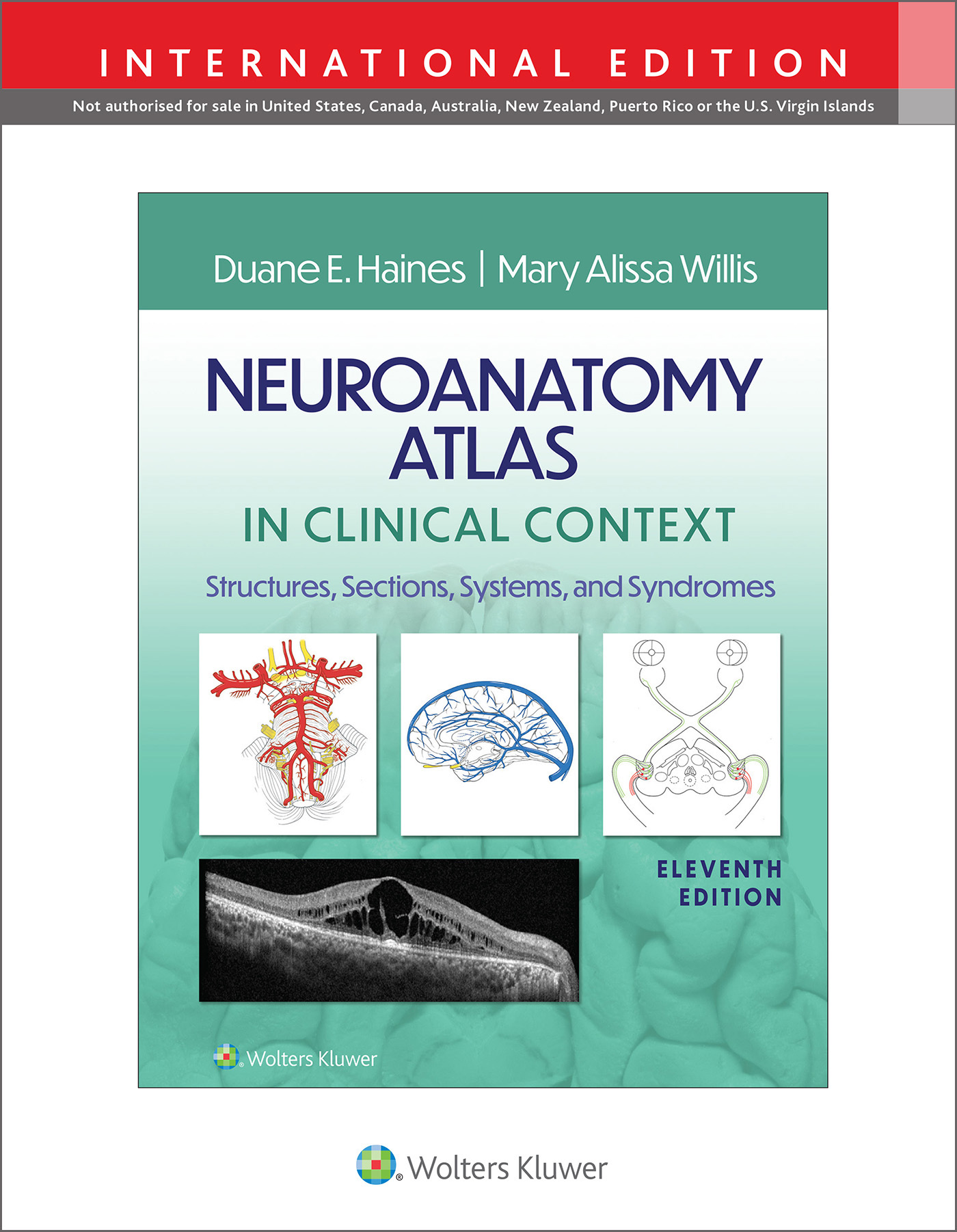 Neuroanatomy Atlas in Clinical Context, 11th ed. (Int'l ed