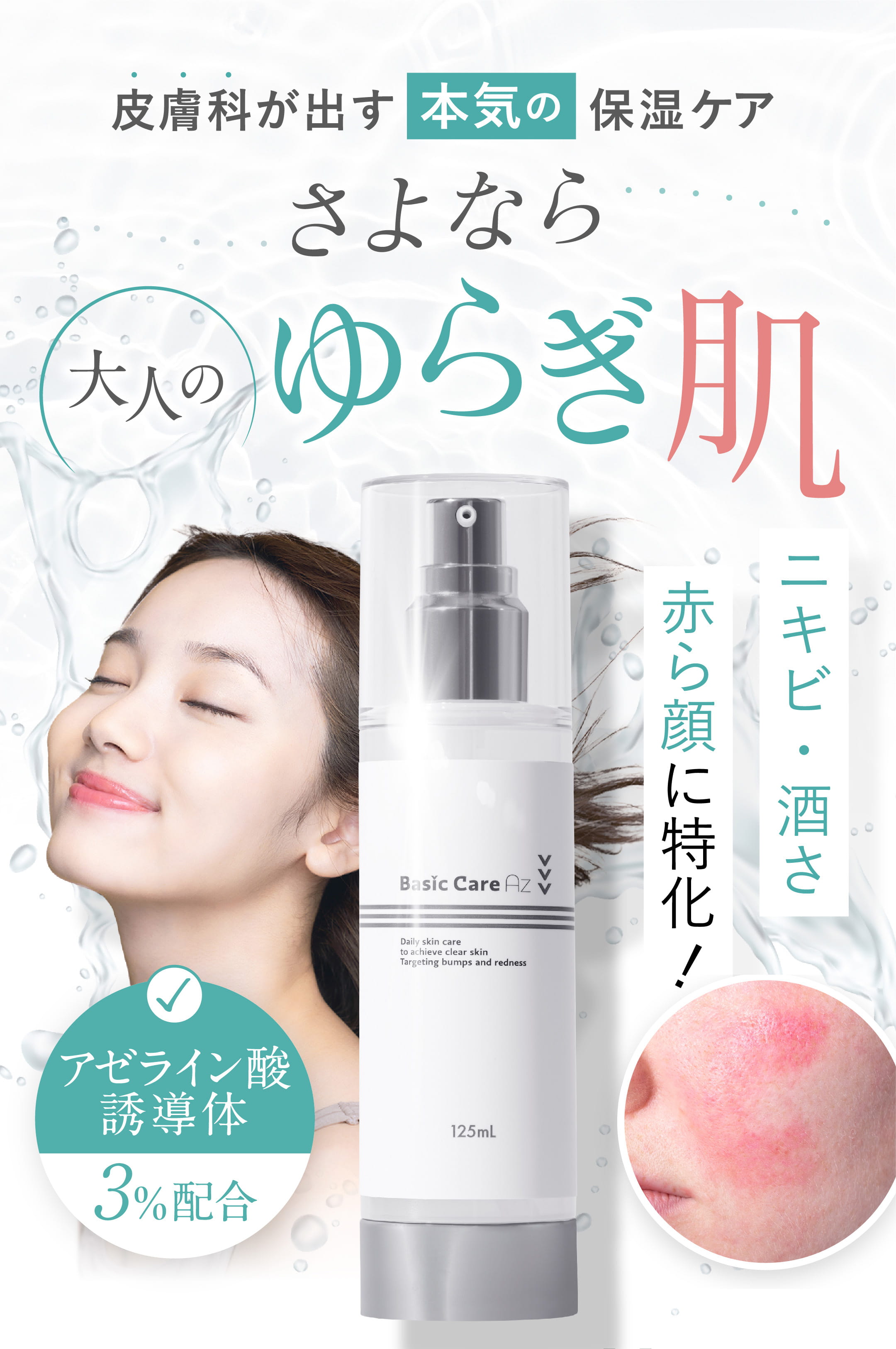 ニキビ・酒さ用保湿薬 ベーシックケアAZクリアローション | 皮膚科