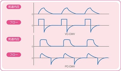 人工呼吸器】CMVの特徴と設定項目 | ナース専科
