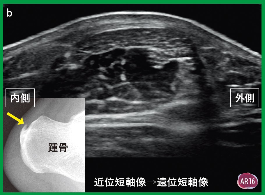 運動器エコーのメタ診療｜動画ライブラリ
