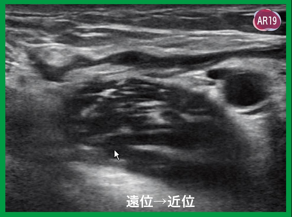 運動器エコーのメタ診療｜動画ライブラリ