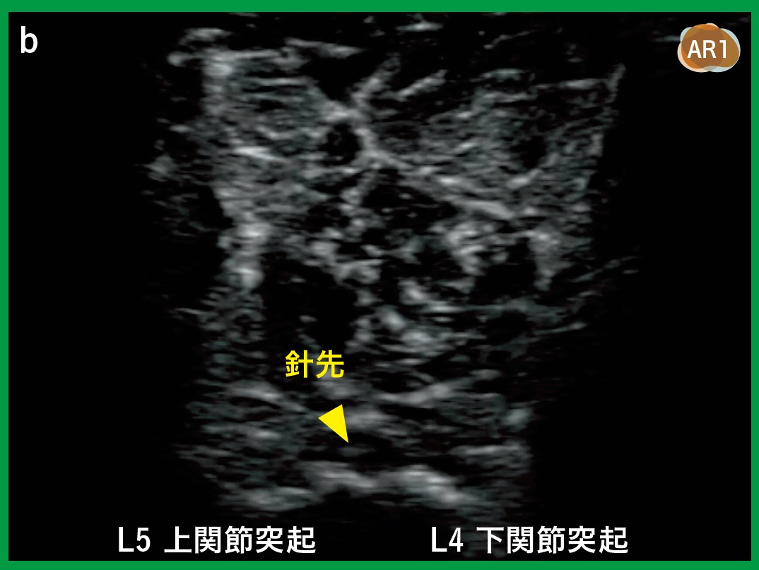 運動器エコーのメタ診療｜動画ライブラリ