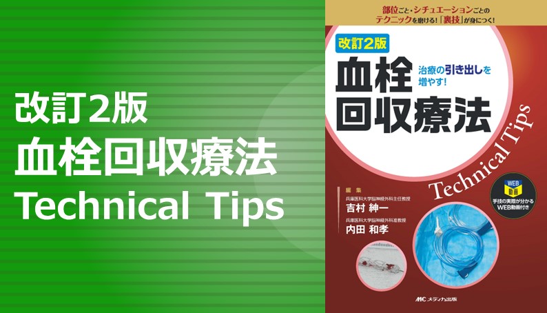 改訂2版 血栓回収療法Technical Tips｜動画ライブラリ