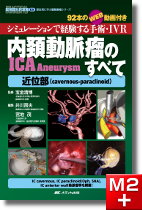m3電子書籍 | 経橈骨動脈脳血管内治療（TRN）超入門