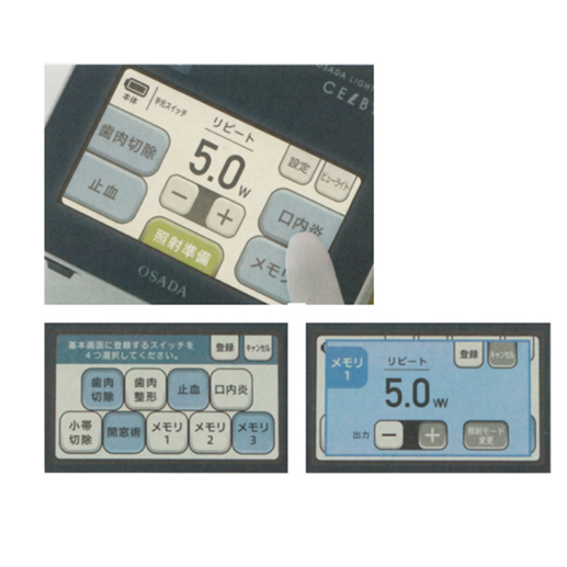 製品詳細「オサダ ライトサージ セルビー」 | フォルディネット